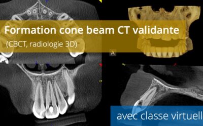 Formation cone beam CT validante (CBCT, radiologie 3D)