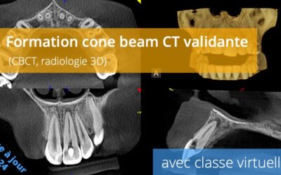 Formation cone beam CT validante (CBCT, radiologie 3D)
